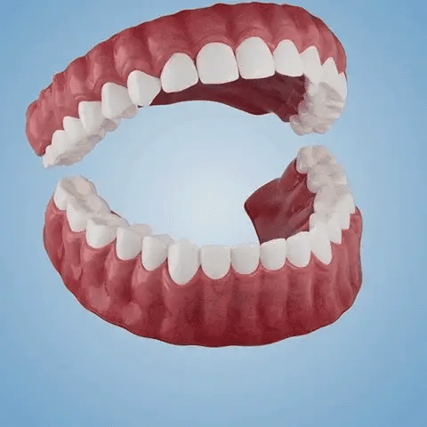 מסתיים היום: חיסכון לזמן מוגבל - שיניים תותבות ROSOPL™ בהתאמה אישית לחיוך בטוח בעצמך